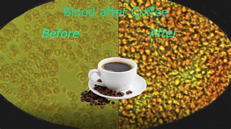 can you drink coffee after blood test